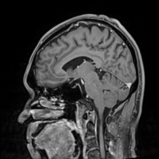 Click on the Serie image to view the images of VILLANUEVA, WILLIAM A.